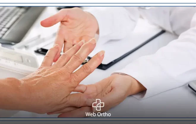 علاج الروماتويد
