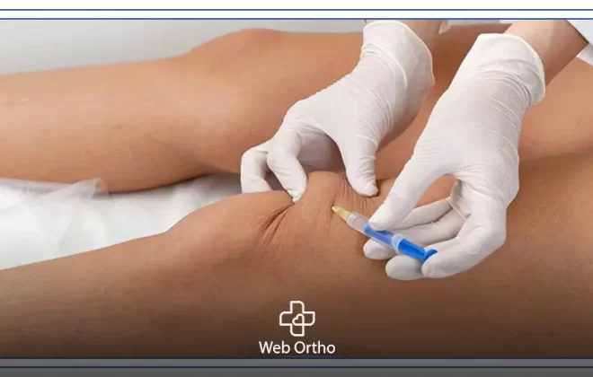 سعر حقن orthovisc
