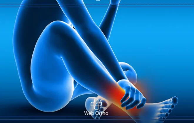 علاج التواء الكاحل وتمزق الاربطة