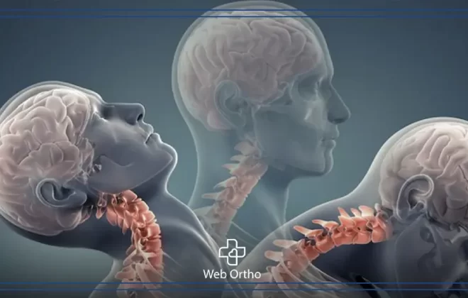 أعراض غضروف الرقبه